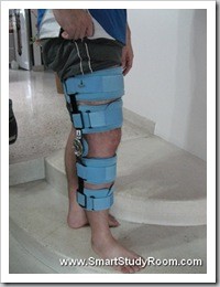 my_leg